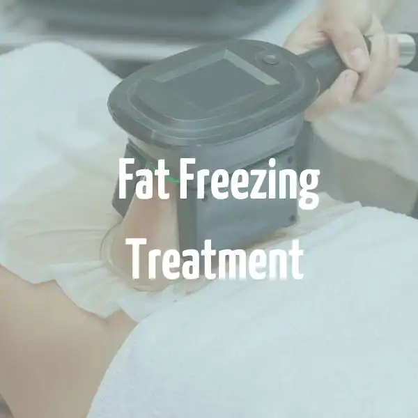 fat freezing treatment Berkshire